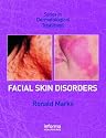 Facial Skin Disorders (Series in Dermatological Treatment)