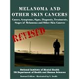 MELANOMA AND OTHER SKIN CANCERS: Causes, Symptoms, Signs, Diag-nosis, Treatments, Stages of Melanoma and Other Skin Cancers