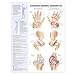 Arthritis - Joint Inflammation Anatomical Chart