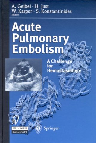 Pulmonary-Embolism