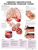 Chronic Obstructive Pulmonary Disease (COPD) Anatomical Chart