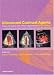 Book Ultrasound Contrast Agents: Basic Principles and Clinical Applications