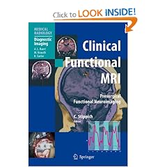 Clinical Functional MRI: Presurgical Functional Neuroimaging (Medical Radiology / Diagnostic Imaging)