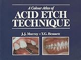 A colour atlas of acid etch technique