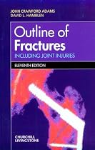 Outline of Fractures: Including Joint Injuries