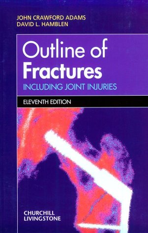 Outline of Fractures: Including Joint Injuries