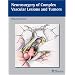 Neurosurgery of Complex Vascular Lesions and Tumors