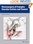 Neurosurgery of Complex Vascular Lesions and Tumors