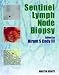 Books : Sentinel Lymph Node Biopsy