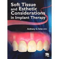 Soft Tissue and Esthetic Considerations in Implant Dentistry