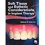 Soft Tissue and Esthetic Considerations in Implant Dentistry