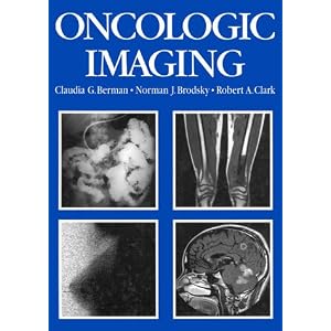 Click here to buy Oncologic Imaging: A Clinical Perspective by Claudia G. Berman, Norman J. Brodsky, and Robert A. Clark.