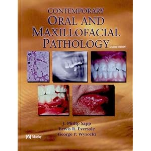 Click here to buy Contemporary Oral and Maxillofacial Pathology by J. Philip Sapp DDS MS, Lewis Roy Eversole DDS MSD MA, and George W. Wysocki DDS PhD.