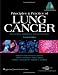 Principles and Practice of Lung Cancer: The Official Reference Text of the International Association for the Study of Lung Cancer (IASLC) (Pass, Lung Cancer) 518f2rF6waL. SL75 Tumours and Cancer, Fact or Fiction. Do Alternative Medicines and Herbal Remedies Really Work against Tumours and Cancer?