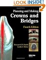 Planning and Making Crowns and Bridges