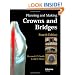 Planning and Making Crowns and Bridges