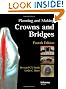 Planning and Making Crowns and Bridges, Fourth Edition