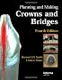 Planning and Making Crowns and Bridges