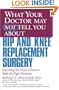 What Your Doctor May Not Tell You About(TM) Hip and Knee Replacement Surgery: Everything You Need to Know to Make the Right Decisions