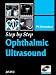 Step by Step Ophthalmic Ultrasound with Photo CD-ROM