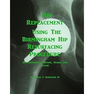 Hip Replacement Using The Birmingham Hip Resurfacing Procedure: My Experiences Before, During and After