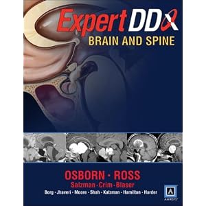 Click here to buy EXPERTddx: Brain and Spine: Published by Amirsys® by Anne G Osborn, Jeff Ross, Julia Crim, and Karen L Salzman.