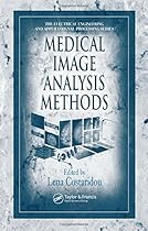 Medical Image Analysis Methods (Electrical Engineering & Applied Signal Processing Series) Medical Image Analysis Methods (Electrical Engineering & Applied Signal Processing Series)