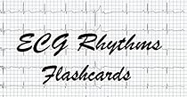 ECG Rhythms Flashcards ECG Rhythms Flashcards