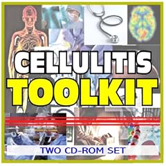 Click here to buy Cellulitis Toolkit - Comprehensive Medical Encyclopedia with Treatment Options, Clinical... by U.S. Government.