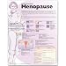   - Understanding Menopause Anatomical Chart (Laminated)