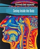 Seeing inside the body