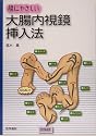 腸にやさしい大腸内視鏡挿入法