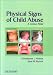 Search : Physical Signs of Child Abuse