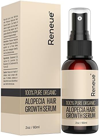 Alopecia Hair Loss Treatment - Alopecia Areata (2oz)