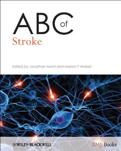 ABC of Stroke (ABC Series)