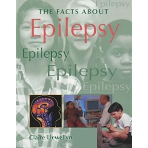 Epilepsy (Facts About)