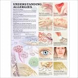 Understanding Allergies Anatomical Chart