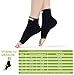 Plantar Fasciitis Socks with Arch & Foot Support Compression Foot Sleeves for Effective Heel, Arch & Ankle Support Improves Circulation, Soothes Achy Feet, Minimizes Foot Pain (1 Pair, Black)