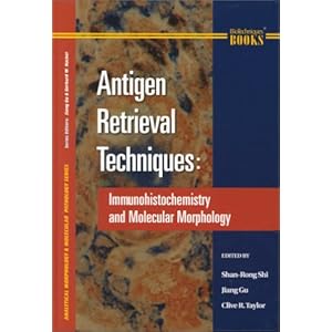 Antigen Retrieval Techniques: