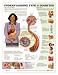 UNDERSTANDING TYPE 2 DIABETES laminated Spanish-9753PL1.5
