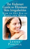 The Kickstart Guide to Eliminate Skin Irregularities: How to Get Rid of Warts and Moles