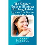 The Kickstart Guide to Eliminate Skin Irregularities: How to Get Rid of Warts and Moles