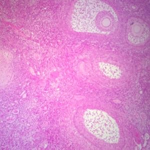 Human Placenta, sec. 7 um H&E