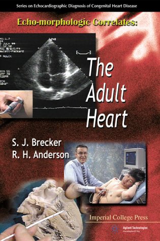 Congenital-Heart-Disease