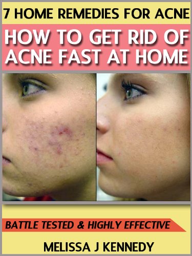 7 Home Remedies for Acne - How to Get Rid of acne Fast at Home
