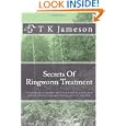 Secrets Of Ringworm Treatment: Everything You Ever Needed To Know About