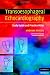 Transoesophageal Echocardiography