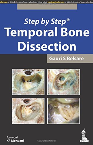 Step by Step Temporal Bone Dissection