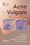 Acne vulgaris