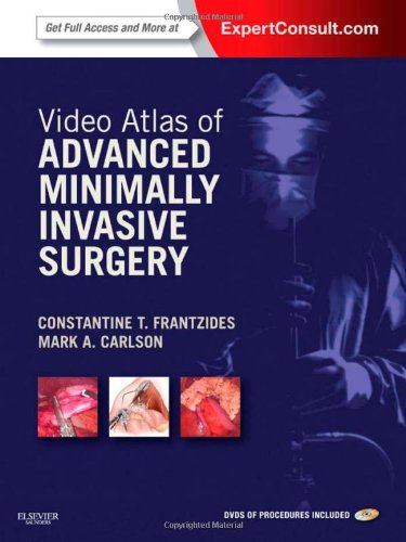 Video Atlas of Advanced Minimally Invasive Surgery: Expert Consult - Online and Print, 1e